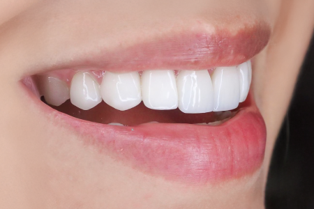 paciente5_dentalface